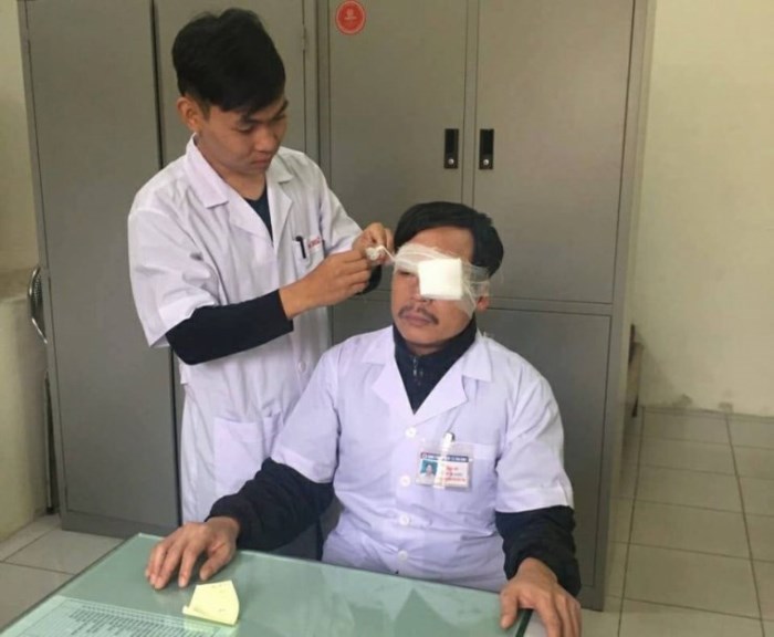 Thái Bình: Bác sĩ bị hành hung và thương tật 14% phải phẫu thuật chỉnh xương mũi