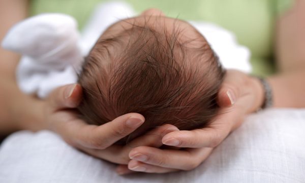 Kinh nghiệm chữa méo đầu sơ sinh dành cho các mẹ 1