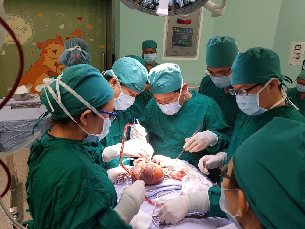 Ca phẫu thuật khối u khổng lồ đầy tóc, lông, xương kỳ dị trên bé 5 ngày tuổi